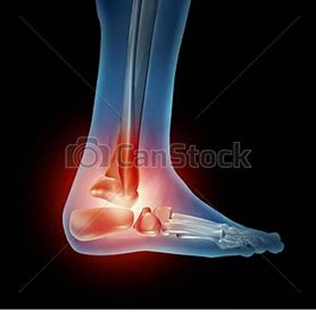 Image result for ankle graphic