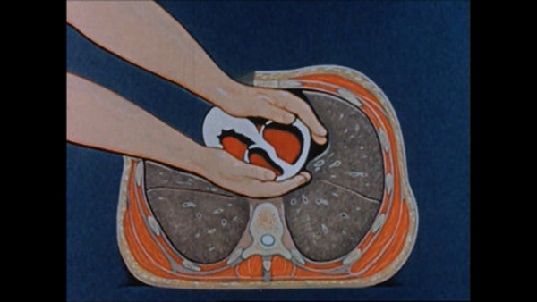 Internal or open-chest cardiac massage. Diagram by Sylvia Treadgold from the film The Treatment of Cardiac Arrest (1958). Wellcome Library reference: